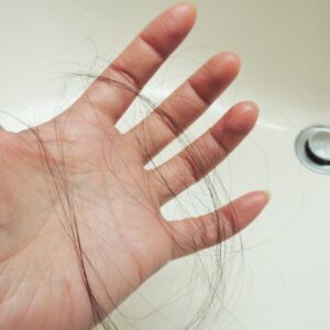 50代AGA治療の決定版！【イースト駅前クリニック】が選ばれる3つの理由