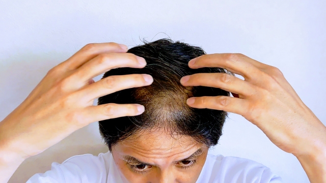 【最終まとめ】50代のAGA治療Q&A 20選：行動前の疑問をゼロにする！