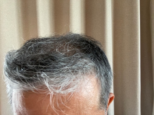 【仕事に響かない】50代のための失敗しないオンラインAGAクリニックの選び方