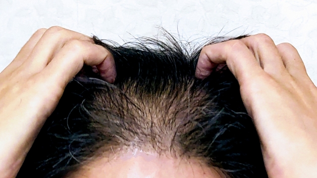 👨‍⚕️ 50代AGA治療の決定版！【イースト駅前クリニック】が選ばれる3つの理由